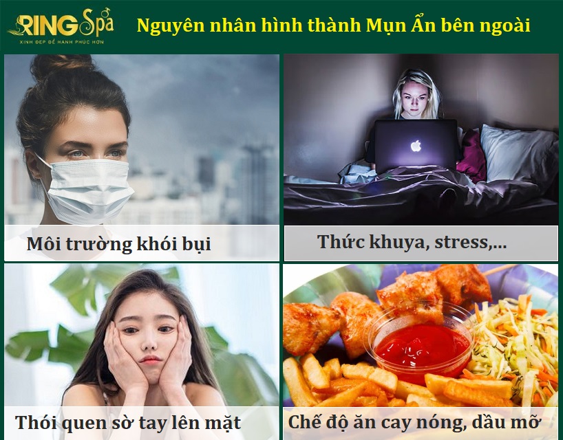 nguyên nhân hình thành mụn mọc 2 bên quai hàm