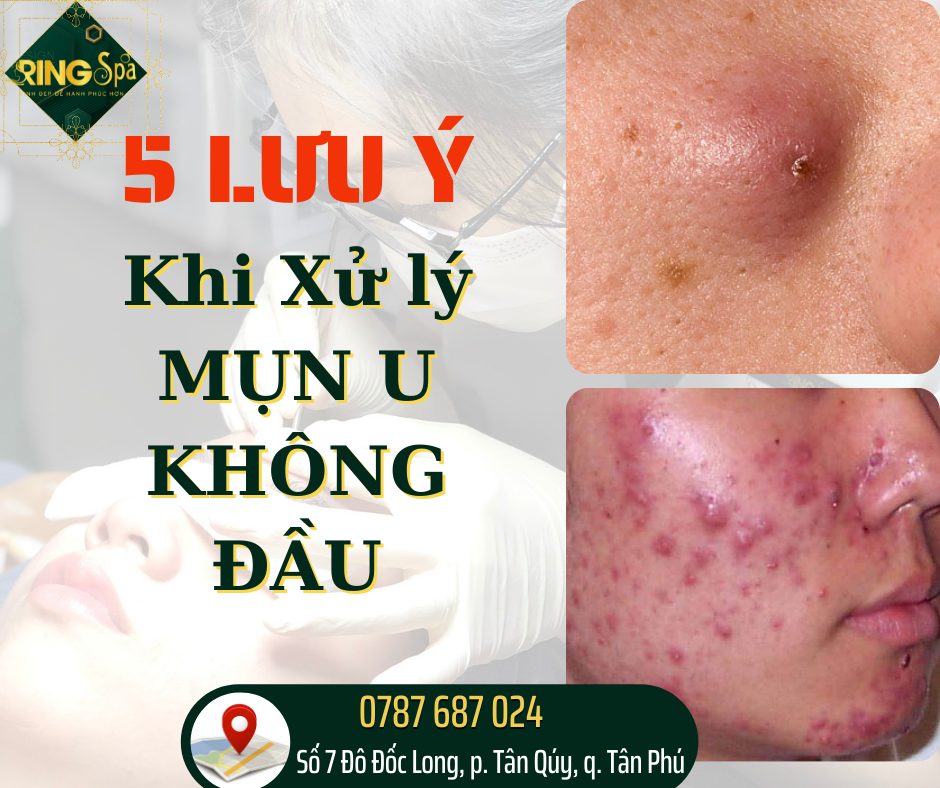 lưu ý khi xử lý mụn u không đầu